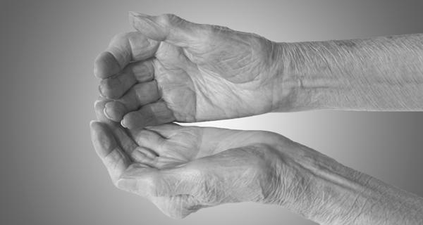 arthritic pain