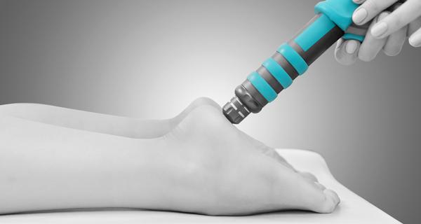 shockwave therapy